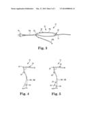 IMPLANTS, TOOLS, AND METHODS FOR TREATMENT OF PELVIC CONDITIONS diagram and image