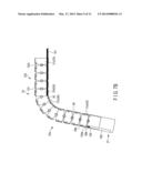 ENDOSCOPE diagram and image