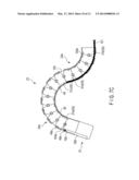 ENDOSCOPE diagram and image