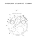 Endoscope diagram and image