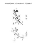 ILLUMINATED SUCTION APPARATUS diagram and image