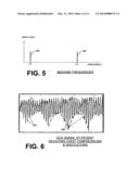 FILTERING PATIENT SIGNAL ALSO FOR VENTILATION ARTIFACTS diagram and image