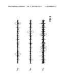 METHOD OF ENHANCING THE SIGNAL-TO-NOISE RATIO (SNR) OF MEASURED     ELECTROCARDIOGRAM (ECG) SIGNALS AND A CARDIAC DEVICE FOR USE IN DETECTING     HEARTBEATS diagram and image