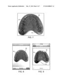 SCREEN-BASED METHOD AND SYSTEM FOR SIZING AN ORAL APPLIANCE diagram and image