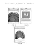 SCREEN-BASED METHOD AND SYSTEM FOR SIZING AN ORAL APPLIANCE diagram and image