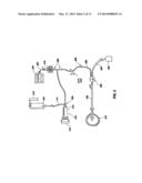 APPARATUS FOR MONITORING INTRA-ABDOMINAL PRESSURE diagram and image