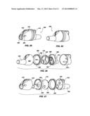 APPARATUS FOR MONITORING INTRA-ABDOMINAL PRESSURE diagram and image