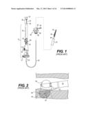 DOUBLE LUMEN OR DOUBLE WIRE ENDOBRONCHIAL ULTRASOUND-GUIDED HISTOLOGY     NEEDLE (EBUS) diagram and image