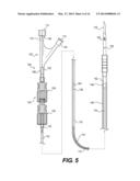 DOUBLE LUMEN OR DOUBLE WIRE ENDOBRONCHIAL ULTRASOUND-GUIDED HISTOLOGY     NEEDLE (EBUS) diagram and image