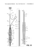 DOUBLE LUMEN OR DOUBLE WIRE ENDOBRONCHIAL ULTRASOUND-GUIDED HISTOLOGY     NEEDLE (EBUS) diagram and image