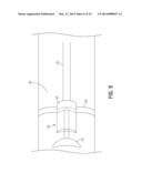 BLEEDING CONTAINMENT DEVICE diagram and image