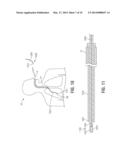 BLEEDING CONTAINMENT DEVICE diagram and image