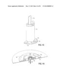 Infusion Device with Automatic Insertion and Introducer Needle Retraction diagram and image