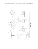 Infusion Device with Automatic Insertion and Introducer Needle Retraction diagram and image