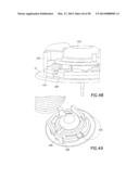 Infusion Device with Automatic Insertion and Introducer Needle Retraction diagram and image