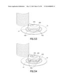 Infusion Device with Automatic Insertion and Introducer Needle Retraction diagram and image