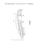 Infusion Device with Automatic Insertion and Introducer Needle Retraction diagram and image