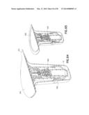 Infusion Device with Automatic Insertion and Introducer Needle Retraction diagram and image