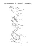 Ring Center Needle diagram and image