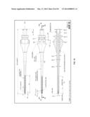 CARTILAGE REPAIR, PRESERVATION AND GROWTH BY STIMULATION OF BONE-CHONDRAL     INTERFASE AND DELIVERY SYSTEM AND METHODS THEREFOR diagram and image