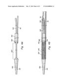 IMPLANT DELIVERY SYSTEM WITH INTERLOCKED RX PORT ORIENTATION diagram and image