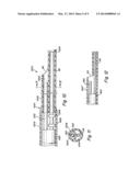 IMPLANT DELIVERY SYSTEM WITH INTERLOCKED RX PORT ORIENTATION diagram and image