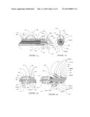 NOVEL DEVICES FOR EFFECTIVE AND UNIFORM SHRINKAGE OF TISSUES AND THEIR     UNIQUE METHODS OF USE diagram and image