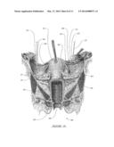 NOVEL DEVICES FOR EFFECTIVE AND UNIFORM SHRINKAGE OF TISSUES AND THEIR     UNIQUE METHODS OF USE diagram and image