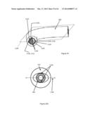 DEVICES AND METHODS FOR LASER SURGERY diagram and image