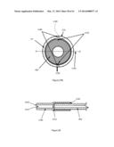 DEVICES AND METHODS FOR LASER SURGERY diagram and image