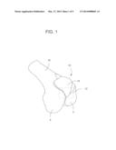 METHODS AND APPARATUS FOR PREPARING A PATIENT S FEMUR FOR PATELLOFEMORAL     KNEE ARTHROPLASTY diagram and image