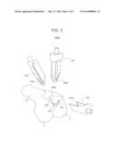 METHODS AND APPARATUS FOR PREPARING A PATIENT S FEMUR FOR PATELLOFEMORAL     KNEE ARTHROPLASTY diagram and image