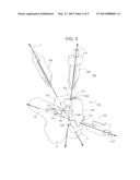 METHODS AND APPARATUS FOR PREPARING A PATIENT S FEMUR FOR PATELLOFEMORAL     KNEE ARTHROPLASTY diagram and image