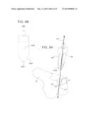 METHODS AND APPARATUS FOR PREPARING A PATIENT S FEMUR FOR PATELLOFEMORAL     KNEE ARTHROPLASTY diagram and image