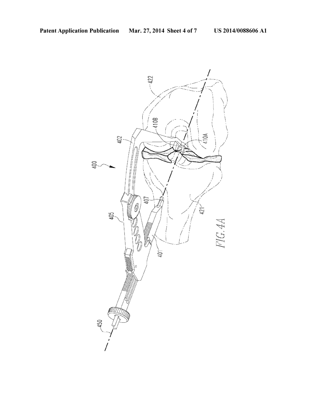 OVAL TIBIA GUIDE - diagram, schematic, and image 05