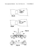 SPLITTABLE SHEATH diagram and image