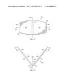 Method of Securing Perianal Support Device diagram and image