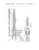 ENHANCED CROSS STREAM MECHANICAL THROMBECTOMY CATHETER diagram and image