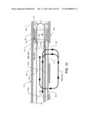 ENHANCED CROSS STREAM MECHANICAL THROMBECTOMY CATHETER diagram and image