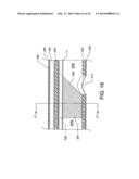 ENHANCED CROSS STREAM MECHANICAL THROMBECTOMY CATHETER diagram and image