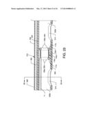 ENHANCED CROSS STREAM MECHANICAL THROMBECTOMY CATHETER diagram and image