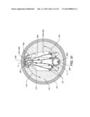 ENHANCED CROSS STREAM MECHANICAL THROMBECTOMY CATHETER diagram and image