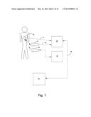 PACEMAKER diagram and image