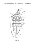 PACEMAKER diagram and image