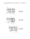 PACEMAKER diagram and image