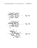 PACEMAKER diagram and image