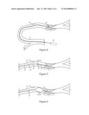 Helically Advancing Constriction Crossing Mechanism And Wire Guide     Positioning Method For Performing Percutaneous Vascular Procedures diagram and image