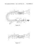 Helically Advancing Constriction Crossing Mechanism And Wire Guide     Positioning Method For Performing Percutaneous Vascular Procedures diagram and image