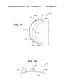 DEVICE AND METHOD FOR THE APPLICATION OF A CURABLE FLUID COMPOSITION TO A     BODILY ORGAN diagram and image