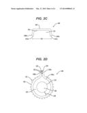 DEVICE AND METHOD FOR THE APPLICATION OF A CURABLE FLUID COMPOSITION TO A     BODILY ORGAN diagram and image